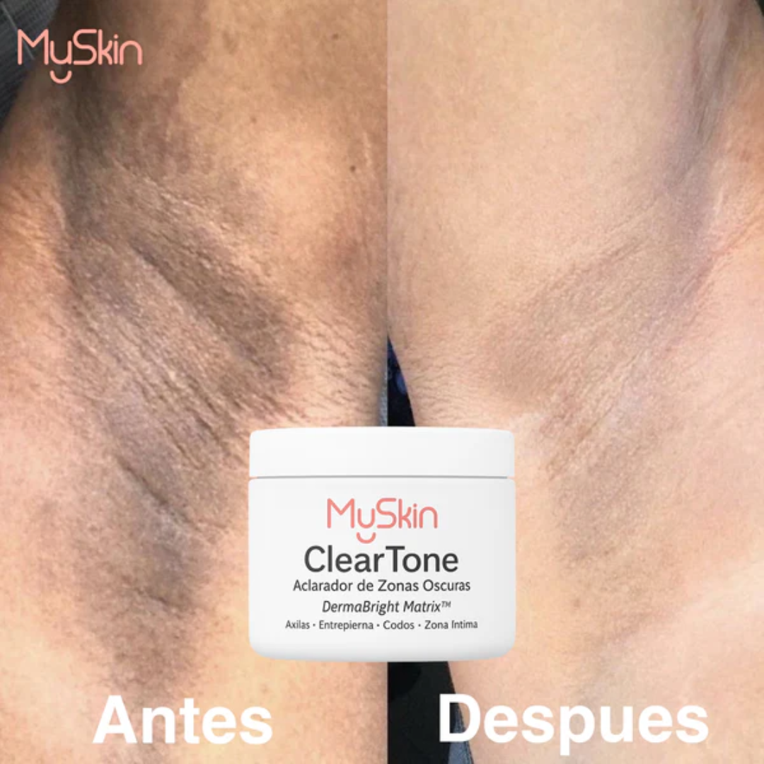 ClearTone – Aclarador de Zonas Oscuras